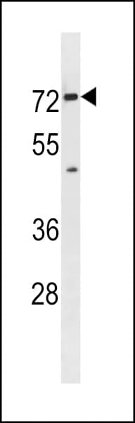 SLC5A8 / AIT Antibody (aa548-574)