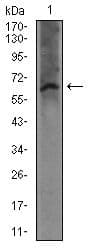 Monoclonal Mouse anti-Human FcERI / Fc Epsilon RI Antibody (clone 1F2A9, Amino Acid: 42-103, WB)