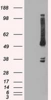 OXSR1 / OSR1 Antibody (clone OTI1F3)