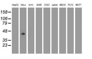 GDAP1L1 Antibody (clone OTI1G5)