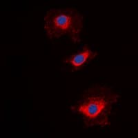 Polyclonal Rabbit anti-Human NT5C1A / CN1A Antibody (Internal, IF, WB)