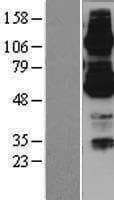ABCB7 Protein (Over-Expression Lysate Myc-DDK (Flag))