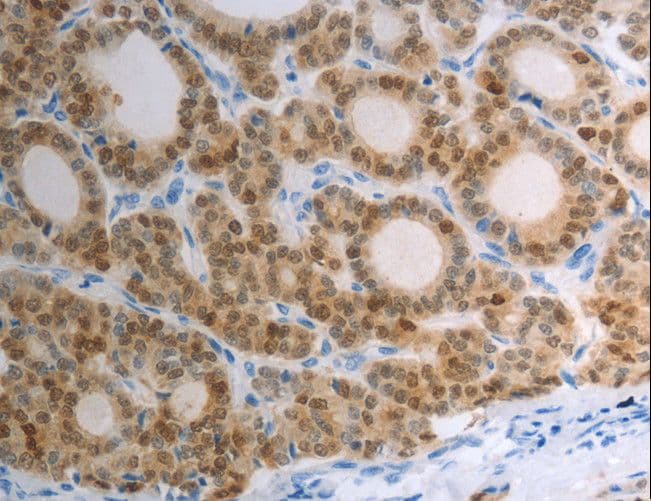 S100A1 / S100-A1 Antibody