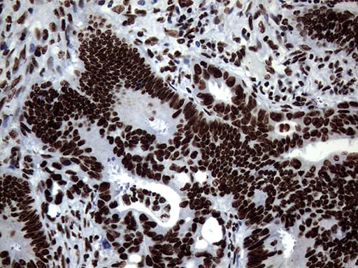 SH3BGRL Antibody (clone OTI8F7)