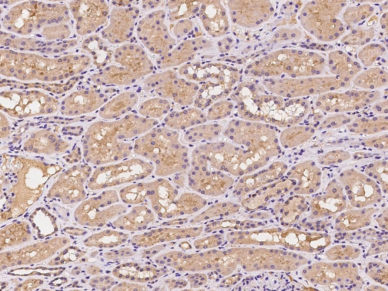 PILRB Antibody