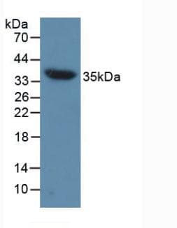 AQP4 / Aquaporin 4 Antibody (aa177-304)
