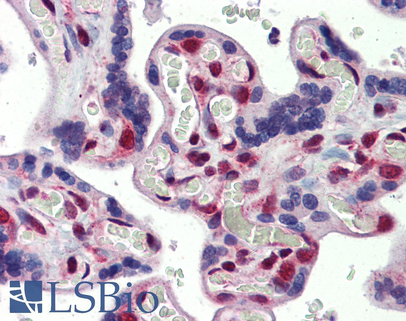 Polyclonal Rabbit anti-Human FUBP3 Antibody (aa503-552, IHC, WB)