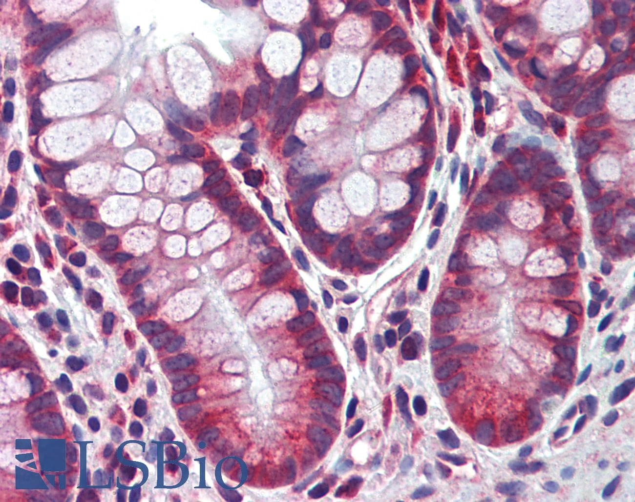 IHC-plus™ Polyclonal Rabbit anti-Human CASP8 / Caspase 8 Antibody (IHC, WB)