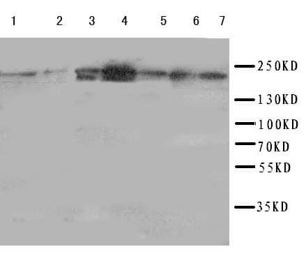 Polyclonal Rabbit anti-Human DCC Antibody (aa162-178, IHC, WB)