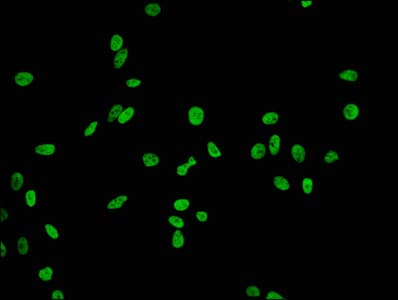 HIST1H2BB Antibody