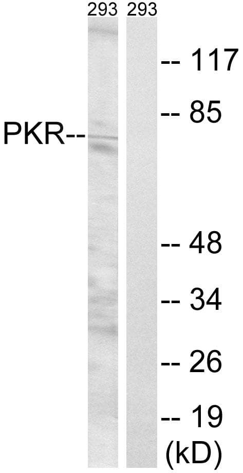 PRKRIR Antibody (p258)