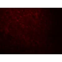 ARID1A / BAF250 Antibody