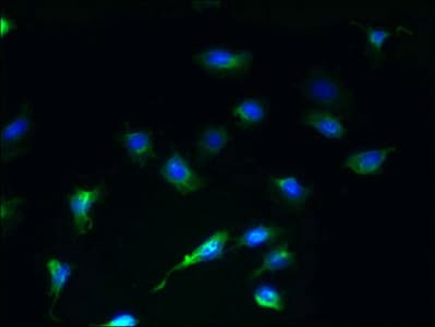 Polyclonal Rabbit anti-Human SCAMP4 Antibody (IHC)