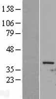 CDK1 / CDC2 Protein (Over-Expression Lysate Myc-DDK (Flag))