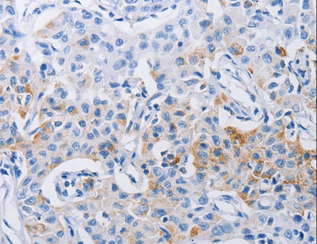 Polyclonal Rabbit anti-Human LRIG1 Antibody (IHC)