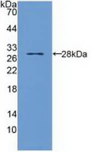 TIRAP Antibody (aa1-221, Biotin)