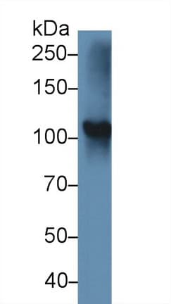TPO / Thyroid Peroxidase Antibody (aa636-832)