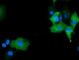 MICAL1 / MICAL Antibody (clone OTI6G2)