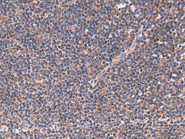 Junctophilin 2 / JPH2 Antibody