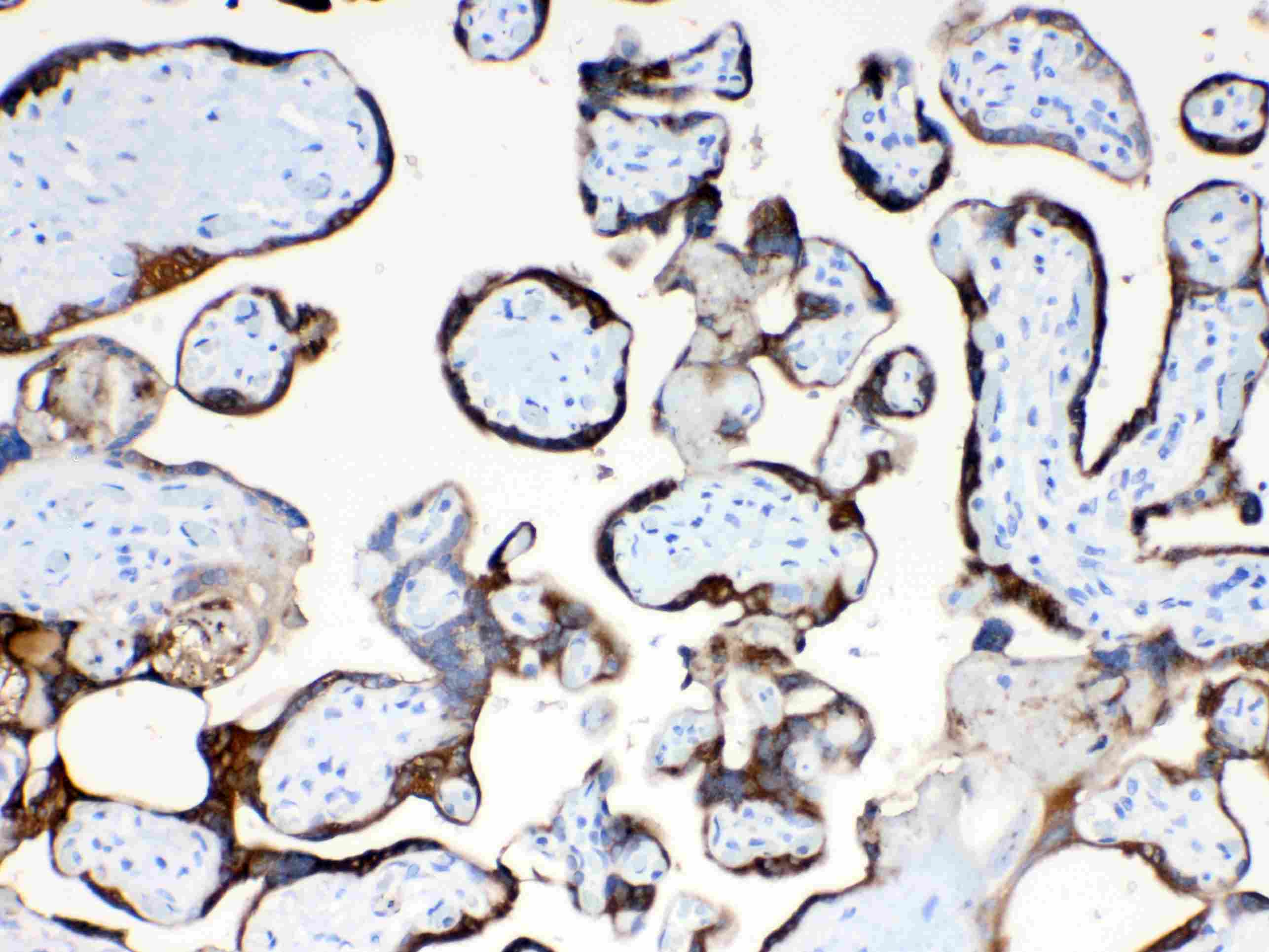TFPI2 Antibody