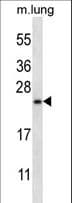 RHEBL1 Antibody (aa17-45)