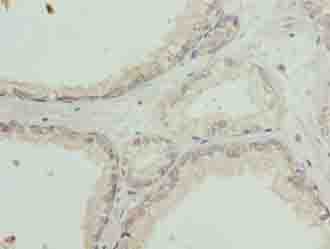 IHC-plus™ Polyclonal Rabbit anti-Human SLC31A2 Antibody (IHC)