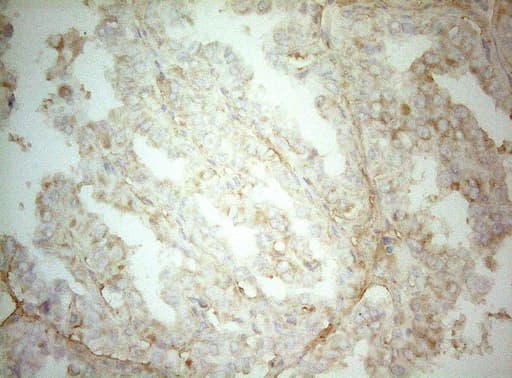 AHSA1 / AHA1 Antibody (aa1-203, clone OTI1D2)