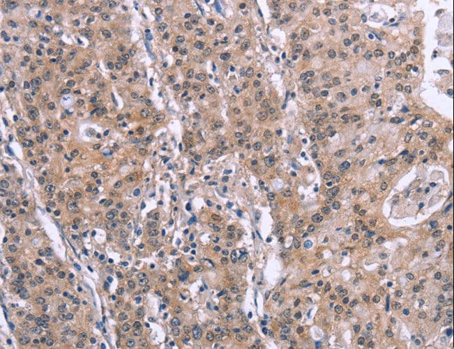 Polyclonal Rabbit anti-Human SLC52A1 / GPR172B / PAR2 Antibody (IHC)