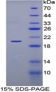 Rabbit LTA / TNF Beta Protein (Recombinant His-T7)