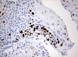 MKI67 / Ki67 Antibody (aa1160-1493, clone OTI13F12)