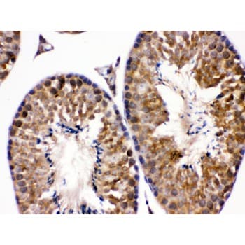 EDNRB / Endothelin B Receptor Antibody (aa406-439)