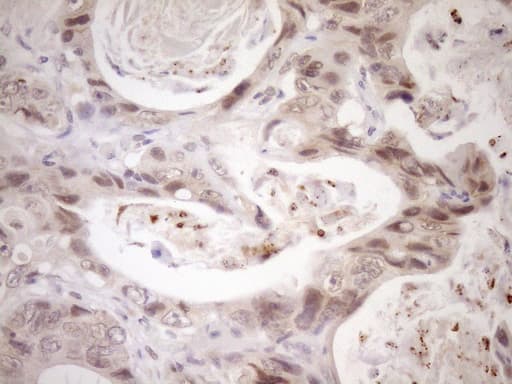 Monoclonal Mouse anti-Human NR2C2 / TAK1 Antibody (clone OTI7E12, aa1-241, IHC, WB)