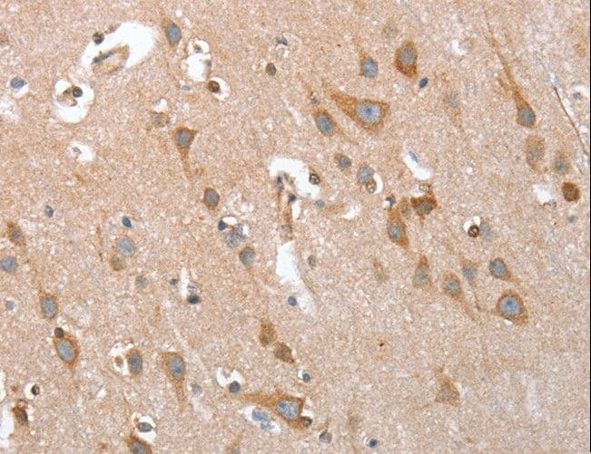 TP53BP2 / ASPP2 Antibody