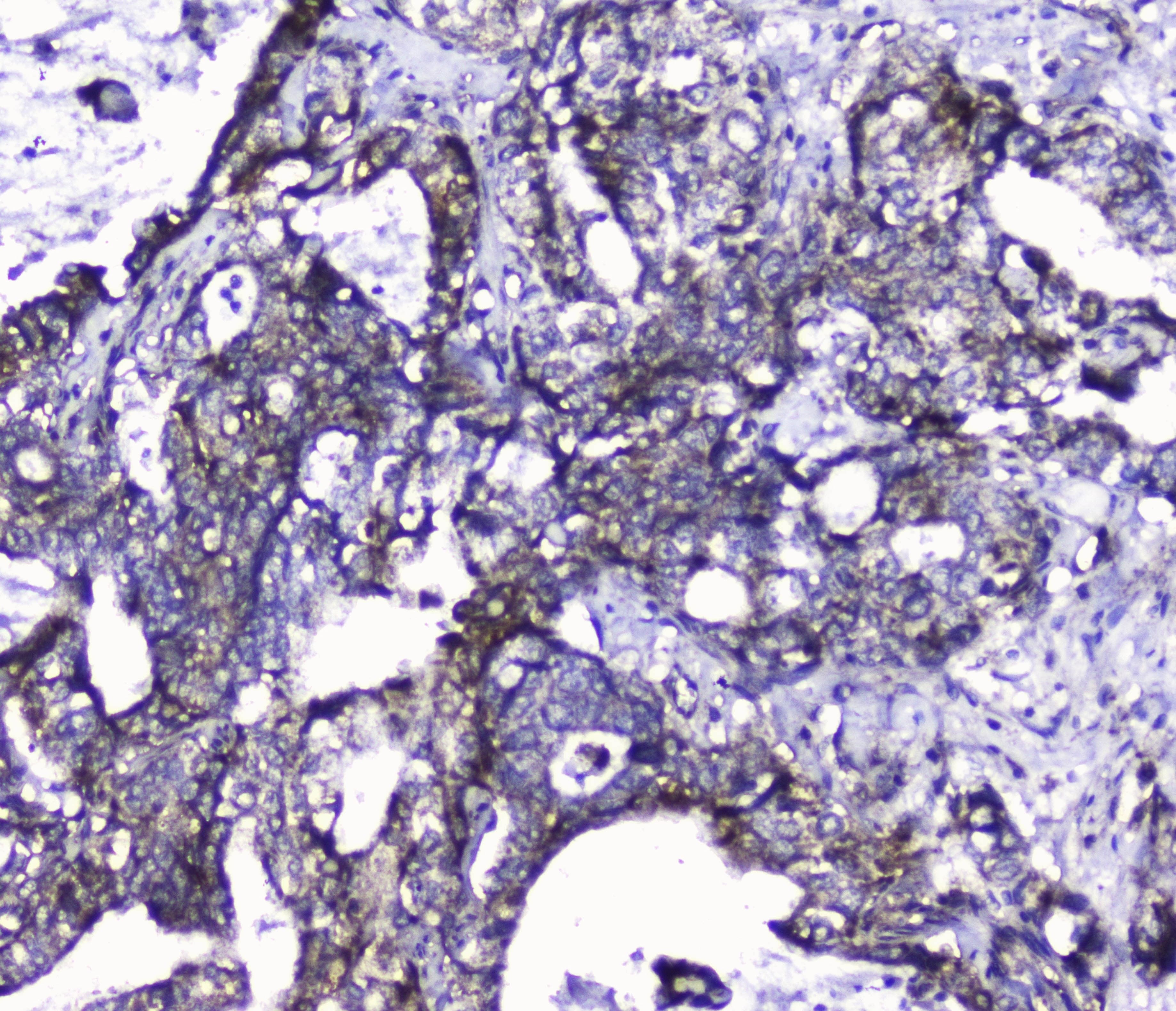 Polyclonal Rabbit anti-Human CDK6 Antibody (WB)