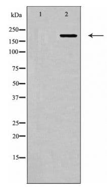 Polyclonal Rabbit anti-Human MYLK Antibody (WB)