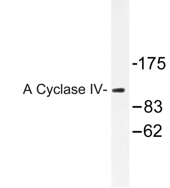 Polyclonal Rabbit anti-Human ADCY4 / Adenylate Cyclase 4 Antibody (Leu226, WB)