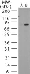 PA / Protective Antigen Antibody (aa186-192)