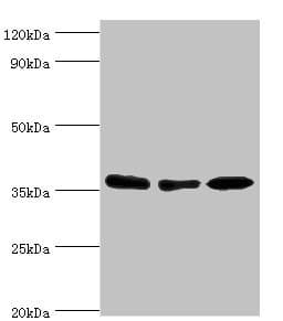 Polyclonal Rabbit anti-Human MDH1 Antibody (aa1-334, IHC, WB)