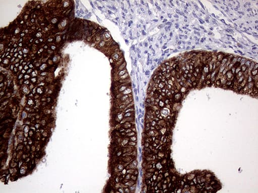 AGR2 Antibody (aa21-175, clone OTI2D11, Carrier-free)
