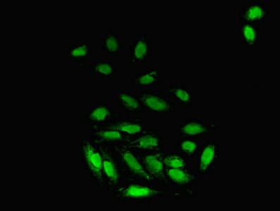 FKBP25 / FKBP3 Antibody (aa2-224)