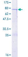 Human CCBL2 Protein (Recombinant GST)