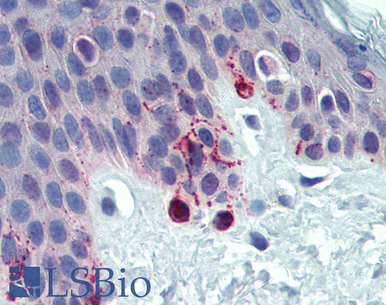 TYRP1 / gp75 Antibody (aa396-445, FITC)