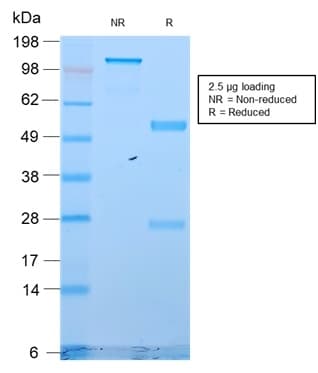 KRT18 / CK18 / Cytokeratin 18 Antibody (clone KRT18/2819R, Azide-free, Carrier-free)