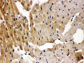 GRK5 Antibody