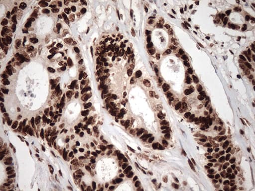 TRIM28 / KAP1 Antibody (clone OTI8B12, Carrier-free)