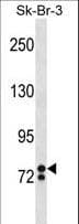 ZNF263 Antibody (aa318-346)