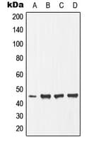 EFNB1 / Ephrin B1 Antibody (phospho-Tyr317)