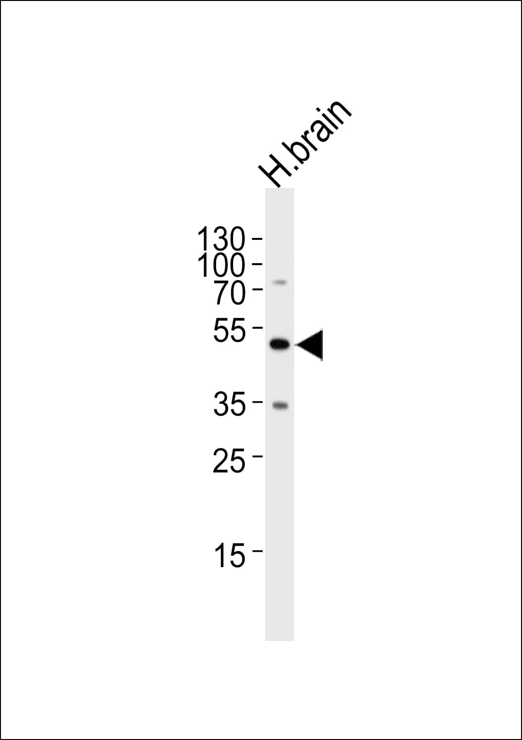 FKTN / Fukutin Antibody (aa177-206)