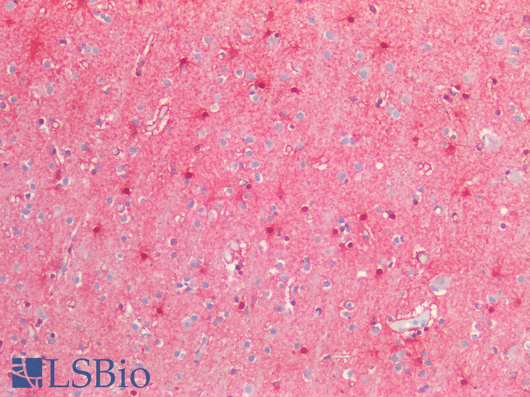 IHC-plus™ S100B / S100 Beta Antibody (clone SA-12)