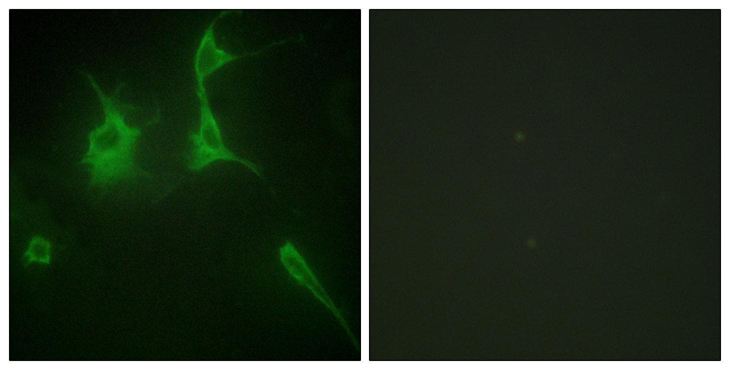Polyclonal Rabbit anti-Human COL9A3 / Collagen IX Antibody (IHC, IF)